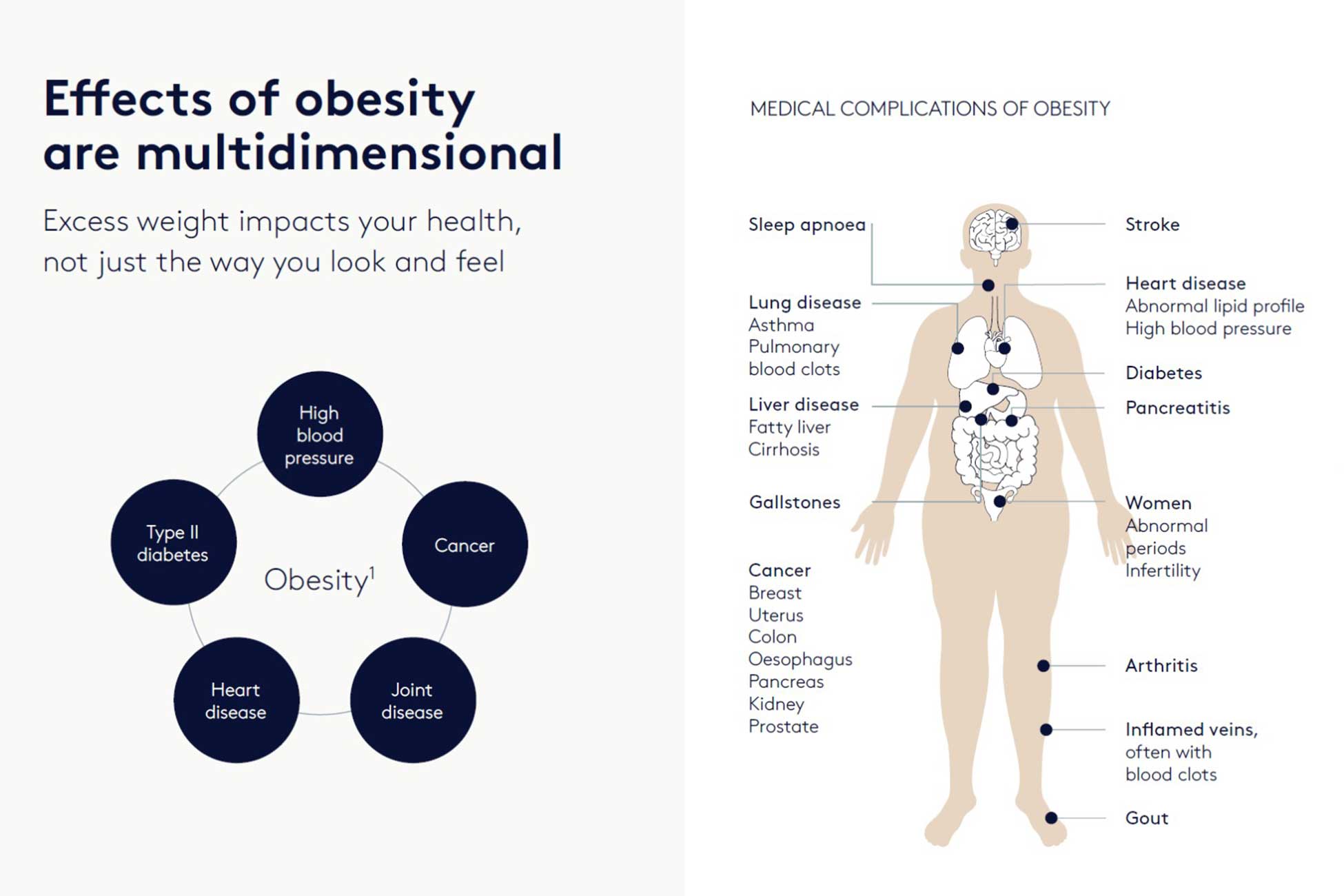 Obesity Effects and Risks